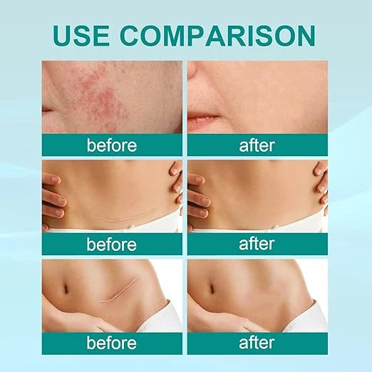 South Moon - Scar Spray  Feature
