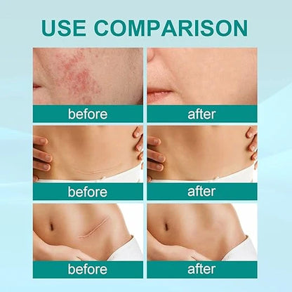 South Moon - Scar Spray  Feature